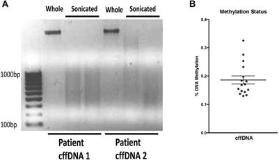 Fetal DNA Causes Sex-Specific Inflammation From Human Fetal Membranes